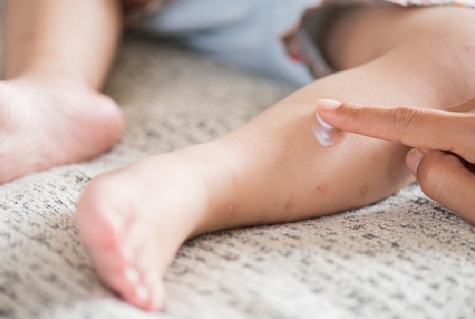 4 Tips Melindungi Bayi dari Gigitan Nyamuk