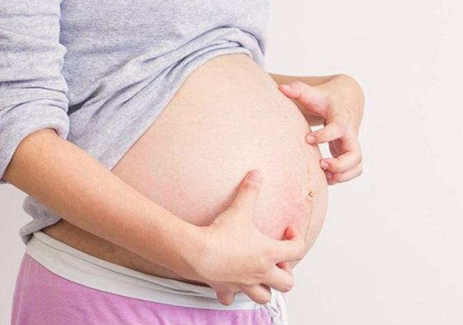 5 Bagian tubuh ini akan muncul stretch mark saat hamil