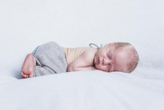5 Kondisi Aneh pada Bayi Baru Lahir