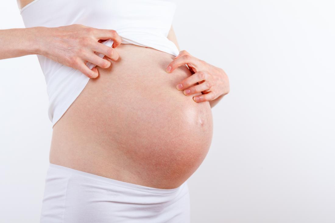 5 Cara Efektif Mengatasi Perut Gatal Saat Hamil