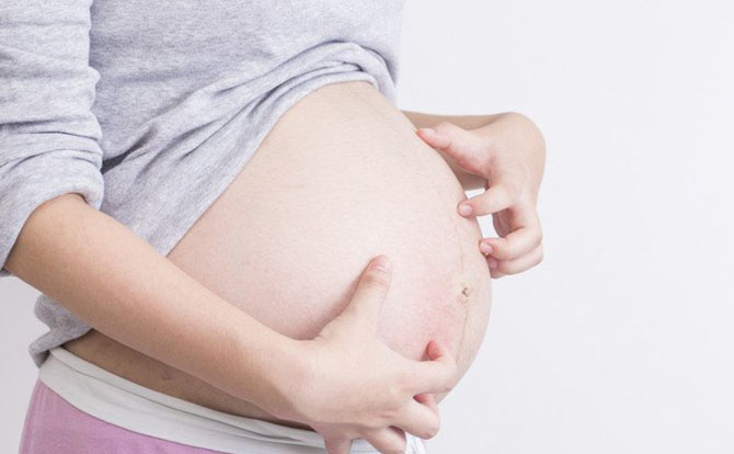 Gatal-gatal Berlebihan Saat Hamil, Mungkin Moms Terkena Kolestasis Obstetri