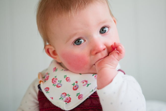 Kenali Jenis Alergi Pada Bayi