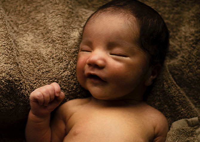 Mata Bayi Belekan, Ini Dia Penyebab & Penanganannya