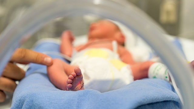 Merawat Bayi Prematur yang Perlu Moms Ketahui