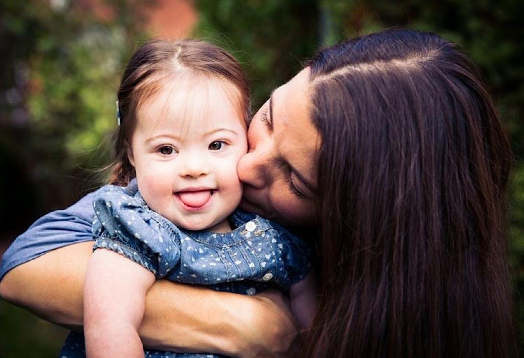 Janin Terdeteksi Down Syndrome, Berikut Penyebab dan Cara Pengobatannya Moms!
