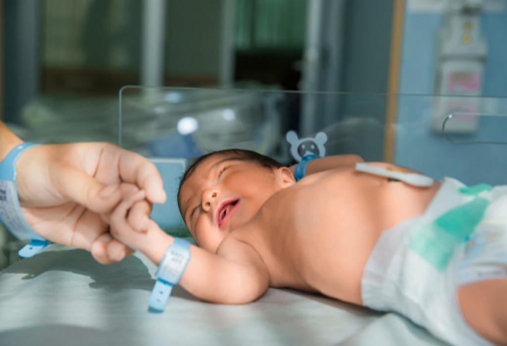 Bagaimana Cara Mengetahui Ciri-ciri Bayi Kuning?