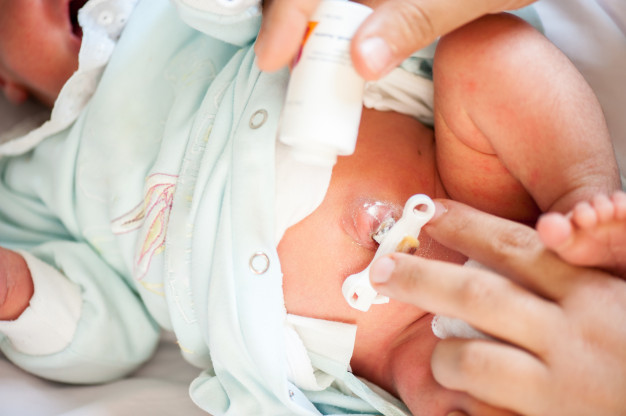 Bayi Terlilit Tali Pusar: Penyebab dan Pencegahannya