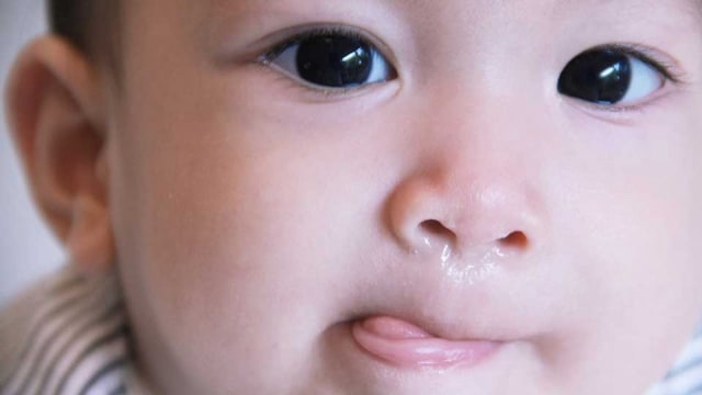 Ampuh, Begini 6 Cara Mengatasi Pilek pada Bayi