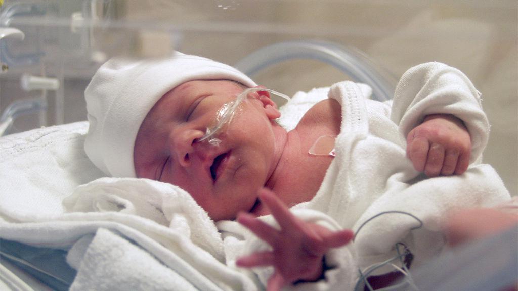 Bayi Prematur, Moms Harus Kenali Penyebab dan Gejalanya