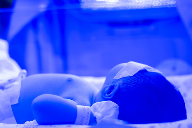 Menjemur Bayi dapat Menghindarkan dari Penyakit Kuning, Mitos atau Fakta?